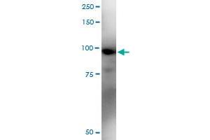 Immunoprecipitation of RIOK1 transfected lysate using anti-RIOK1 MaxPab rabbit polyclonal antibody and Protein A Magnetic Bead , and immunoblotted with RIOK1 purified MaxPab mouse polyclonal antibody (B02P) . (RIOK1 antibody  (AA 1-568))