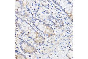 Immunohistochemistry of paraffin-embedded Human colon using WBSCR27 Rabbit pAb (ABIN7271366) at dilution of 1:50 (40x lens). (WBSCR27 antibody  (AA 1-245))