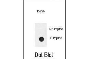 Dot Blot (DB) image for anti-Phosphinothricin N-Acetyltransferase (BAR2) (pSer261) antibody (ABIN3001865) (BAR2 antibody  (pSer261))