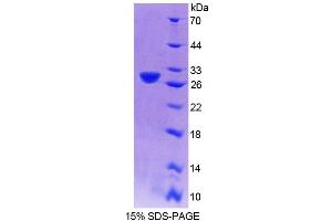 SDS-PAGE (SDS) image for Centromere Protein J (CENPJ) (AA 1-204) protein (His tag) (ABIN4989103) (CENPJ Protein (AA 1-204) (His tag))