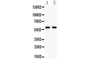Anti- KAT13A antibody, Western blotting All lanes: Anti KAT13A  at 0. (NCOA1 antibody  (AA 614-826))