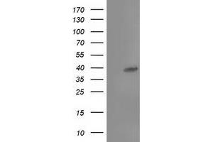 Western Blotting (WB) image for anti-TBC1 Domain Family, Member 21 (TBC1D21) antibody (ABIN1501313) (TBC1D21 antibody)