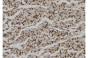 ABIN6260913 and ABIN6273210 at 1/100 staining Human lung tissue by IHC-P. (CNOT10 antibody  (Internal Region))