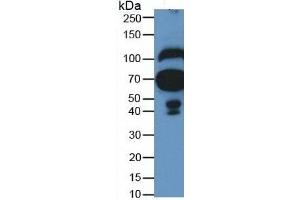 Mouse Detection antibody from the kit in WB with Positive Control: Human serum.