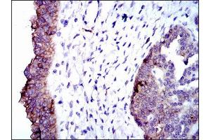 Immunohistochemistry (IHC) image for anti-Alkaline Phosphatase, Liver/bone/kidney (ALPL) antibody (ABIN1845845) (ALPL antibody)