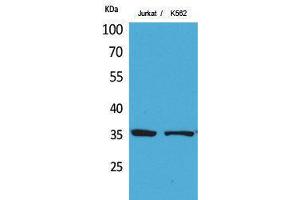 Western Blotting (WB) image for anti-Apurinic/Apyrimidinic Endonuclease 1 (APEX1) (Ser1423) antibody (ABIN3178351) (APEX1 antibody  (Ser1423))