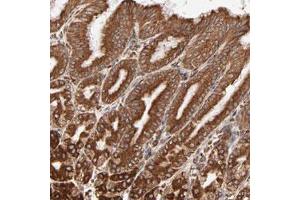 Immunohistochemical staining of human stomach with PDIA3 polyclonal antibody  shows strong cytoplasmic positivity in glandular cells at 1:500-1:1000 dilution. (PDIA3 antibody)