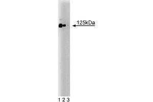 Western blot analysis of CD51 (Integrin alphaV) on a rat cerebrum lysate. (CD51 antibody  (AA 609-722))