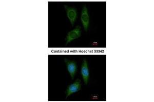 ICC/IF Image Immunofluorescence analysis of methanol-fixed HeLa, using STK25, antibody at 1:200 dilution. (STK25 antibody)