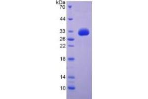 SDS-PAGE of Protein Standard from the Kit  (Highly purified E. (EGF ELISA Kit)