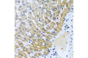 Immunohistochemistry of paraffin-embedded human liver using CPA6 antibody at dilution of 1:100 (40x lens). (CPA6 antibody)