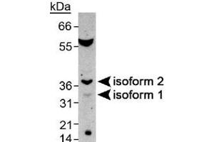 Western blot analysis of SPDYA in mouse testis with SPDYA polyclonal antibody . (SPDYA antibody  (AA 200-286))