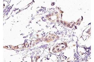 GGA2 antibody  (C-Term)