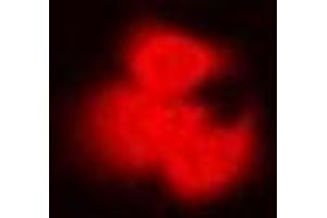 Immunofluorescent analysis of PP2C-alpha staining in Hela cells.