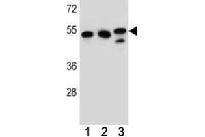 TUBB6 antibody western blot analysis in K562, HeLa, MDA-MB231 lysate. (TUBb6 antibody  (AA 139-166))