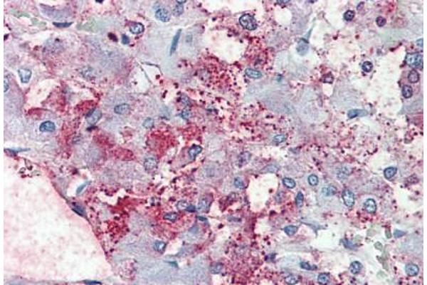 THEM6 antibody  (Internal Region)