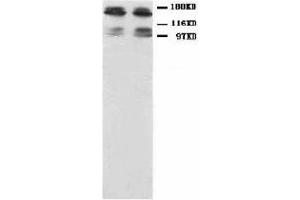 Image no. 1 for anti-Glutamate Receptor, Ionotropic, N-Methyl D-Aspartate 2B (GRIN2B) (N-Term) antibody (ABIN1494122) (GRIN2B antibody  (N-Term))
