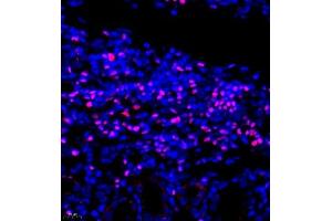 Immunofluorescence of paraffin embedded rat kidney using TCF7 (ABIN7075952) at dilution of 1:600 (400x lens)