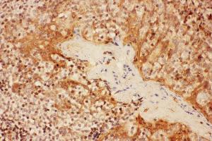 Immunohistochemistry (IHC) image for anti-Interleukin 2 Receptor, alpha (IL2RA) (AA 39-57), (N-Term) antibody (ABIN3044139)
