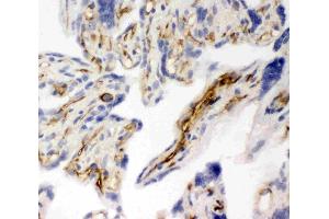 Anti-CD31 antibody, IHC(F): Human Placenta Tissue (CD31 antibody  (C-Term))