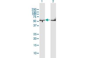 Western Blot analysis of TBL2 expression in transfected 293T cell line by TBL2 MaxPab polyclonal antibody. (TBL2 antibody  (AA 1-447))