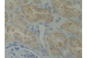 IHC-P analysis of Human Kidney Tissue, with DAB staining. (BMX antibody  (AA 287-523))
