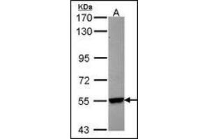 Sample (30 µg of whole cell lysate).