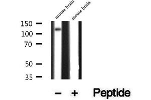 Western blot analysis of extracts of mouse brain tissue, using ATP8A1 antibody. (ATP8A1 antibody  (Internal Region))