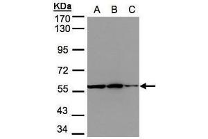 WB Image Sample(30 μg of whole cell lysate) A:293T B:A431, C:HeLa S3, 7. (PHGDH antibody  (N-Term))