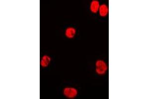 Immunofluorescent analysis of Lamin A/C staining in HeLa cells. (Lamin A/C antibody  (Center))