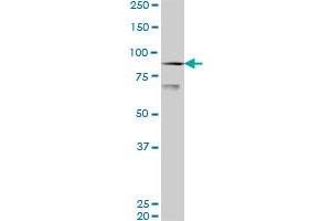 Western Blotting (WB) image for anti-K(lysine) Acetyltransferase 2B (KAT2B) (AA 353-452) antibody (ABIN522308)