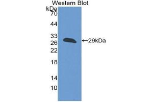 Western blot analysis of the recombinant protein. (Clusterin antibody  (AA 223-439))
