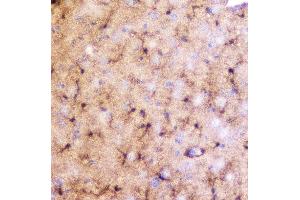 IHC analysis of LRTOMT using anti-LRTOMT antibody (ABIN7602986). (Leucine Rich Transmembrane and 0-Methyltransferase Domain Containing (LRTOMT) (Middle Region) antibody)