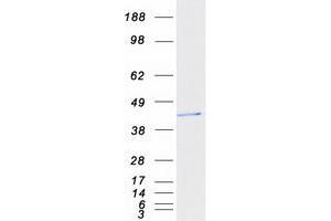 Western Blotting (WB) image for Toll-Like Receptor Adaptor Molecule 2 (TICAM2) protein (Myc-DYKDDDDK Tag) (ABIN2733703)