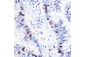 Immunohistochemistry (IHC) image for anti-Geminin, DNA Replication Inhibitor (GMNN) (AA 1-209) antibody (ABIN6141186)