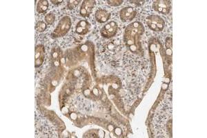 Immunohistochemical staining of human duodenum with NEO1 polyclonal antibody  shows moderate nuclear and cytoplasmic positivity in glandular cells at 1:10-1:20 dilution.