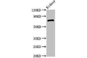 Western Blot Positive WB detected in: Mouse kidney tissue All lanes: ZBTB16 antibody at 2. (ZBTB16 antibody  (AA 126-420))