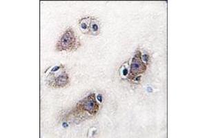 Image no. 2 for anti-Cytochrome P450, Family 26, Subfamily C, Polypeptide 1 (CYP26C1) (C-Term) antibody (ABIN360260) (CYP26C1 antibody  (C-Term))
