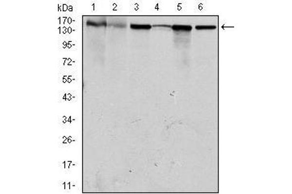 MSH6 antibody