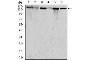 Western blot analysis using MSH6 mouse mAb against HEK293 (1), HCT116 (2), A549 (3), A431 (4), MCF-7 (5) and HepG2 (6) cell lysate.