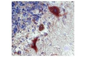 CALB1 Antibody (ARP60104_P050) tested with human purkinje fibers in Immunohistochemistry (CALB1 antibody  (C-Term))