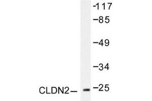Image no. 2 for anti-Claudin 2 (CLDN2) antibody (ABIN265361) (Claudin 2 antibody)