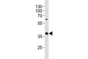 Western blot analysis of lysate from human spleen tissue lysate using CD40 antibody diluted at 1:1000. (CD40 antibody  (AA 247-276))