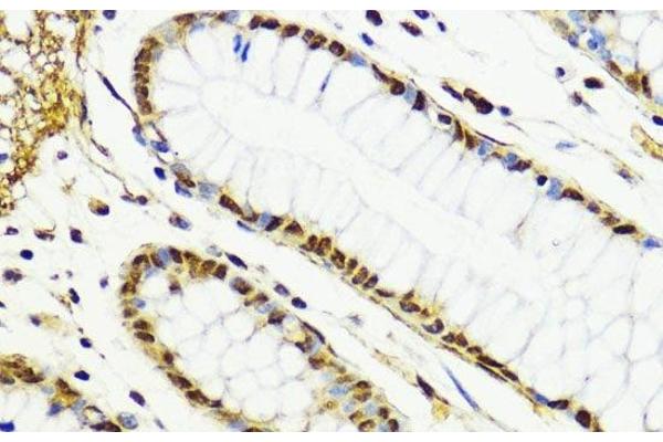 CTCF antibody