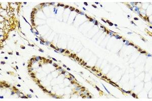 Immunohistochemistry of paraffin-embedded Human colon using CTCF Polyclonal Antibody at dilution of 1:100 (40x lens). (CTCF antibody)
