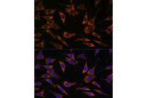 Immunofluorescence analysis of L929 cells using RPS25 antibody (ABIN7270020) at dilution of 1:100. (RPS25 antibody  (C-Term))