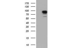 Western Blotting (WB) image for anti-phosphoinositide-3-Kinase Adaptor Protein 1 (PIK3AP1) antibody (ABIN1496824) (PIK3AP1 antibody)