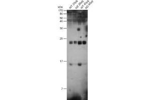 Figure: 20 or 40 ug of total protein from Arabidopsis thaliana (WT) Leafs or ferredoxin mutant fd2 were separated on 15 % acrylamide gel with 6 M urea.