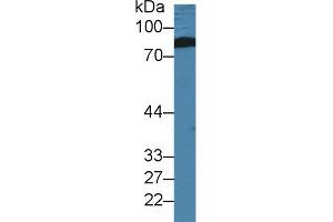 Western Blot; Sample: Human Serum; Primary Ab: 2µg/ml Rabbit Anti-Human LRRFIP1 Antibody Second Ab: 0. (LRRFIP1 antibody  (AA 615-735))