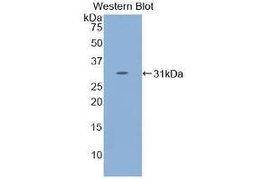 Western Blotting (WB) image for anti-Signal Transducer and Activator of Transcription 4 (STAT4) (AA 505-737) antibody (ABIN3206144)
